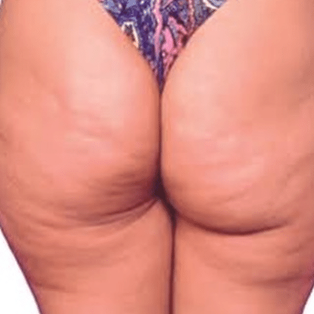 Adriane Galisteu posta foto de bumbum com celulite no Instagram: "Essa sou eu" - Reprodução/Instagram - Reprodução/Instagram
