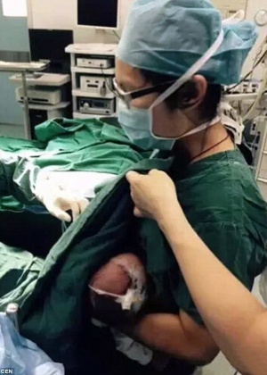 A bebê se acalmou enquanto mamava - Reprodução/Daily Mail