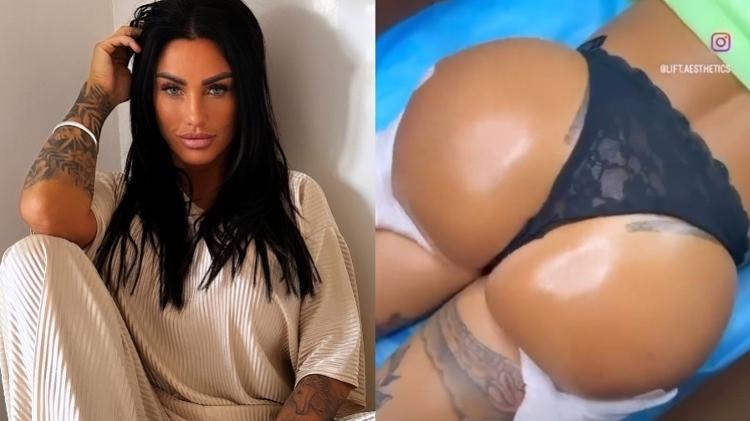 Modelo Katie Price exibe resultado de procedimento no bumbum