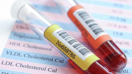 test del colesterolo test del sangue - iStock