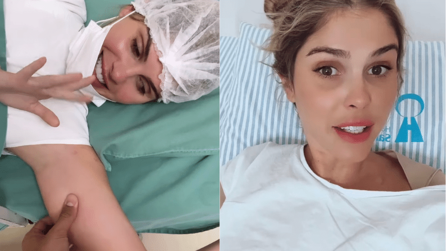 Bárbara Evans mostrou passo a passo antes e depois de cirurgia para tirar gordura do braço direito - Reprodução/Instagram/@barbaraevans22