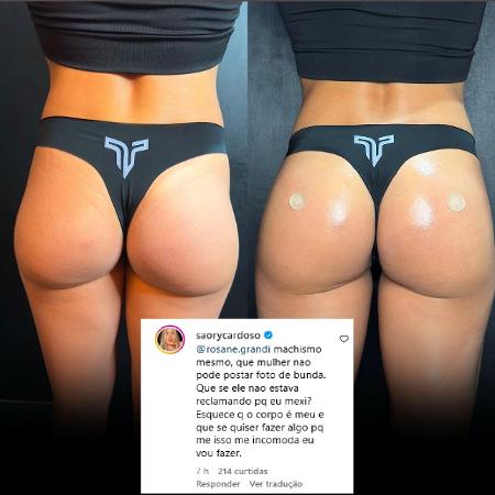 Saory Cardoso divulga resultado de preenchimento no bumbum e explica término com Marcello Novaes Saory Cardoso divulga resultado de preenchimento no bumbum e explica término com Marcello Novaes