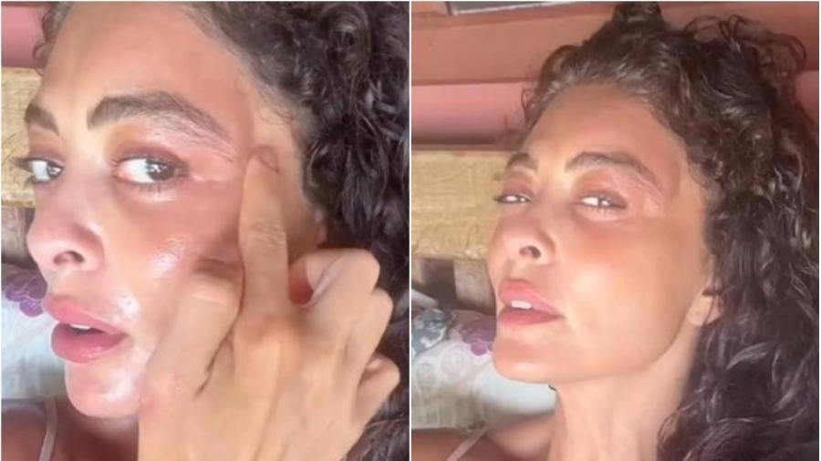 Juliana Paes mostra rosto inchado após picada de inseto no Pantanal - Reprodução/Instagram