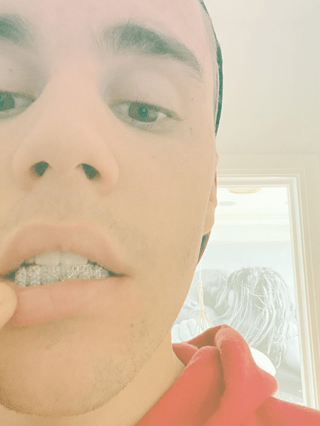 Justin Bieber posta foto com placa de diamante nos dentes - Reprodução/Instagram/@justinbieber