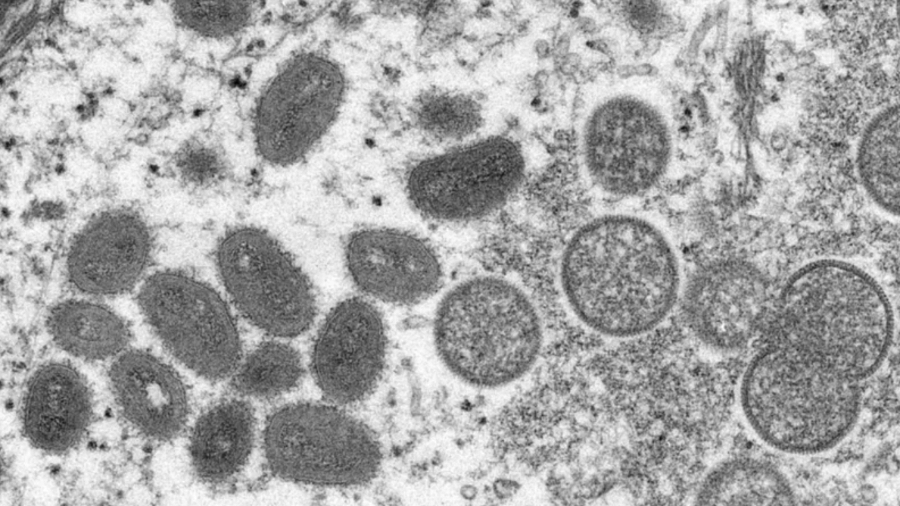 O monkeypox visto em microscópio eletrônico - CDC/REUTERS via BBC News Brasil