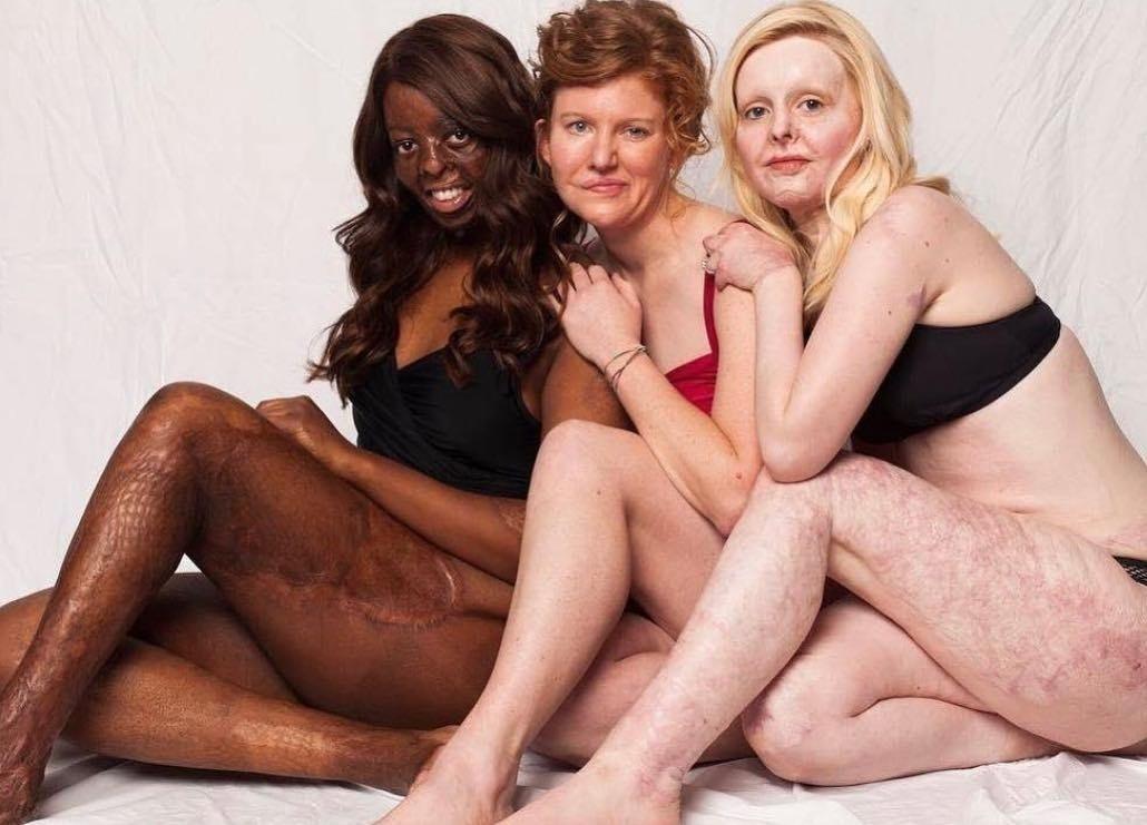 Raiche Mederick  - Reprodução/Instagram/raiche_x