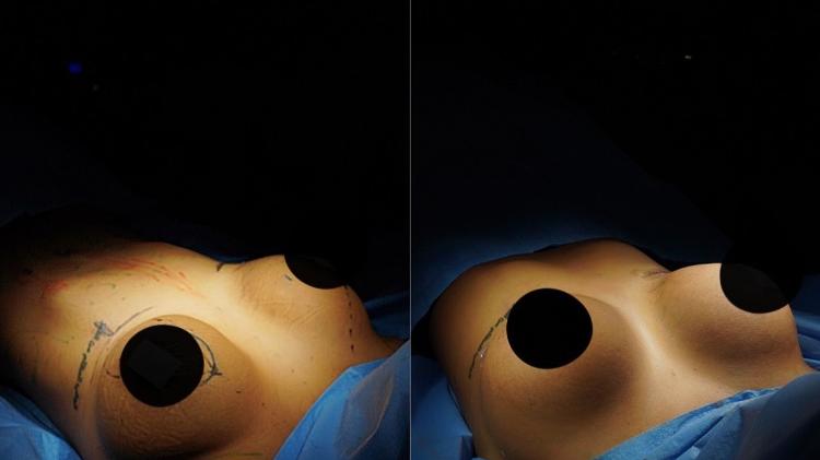 Lorena Maria: antes e depois Lorena Maria: antes e depois