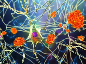 Molécula descoberta por brasileiros é a nova promessa contra o Alzheimer