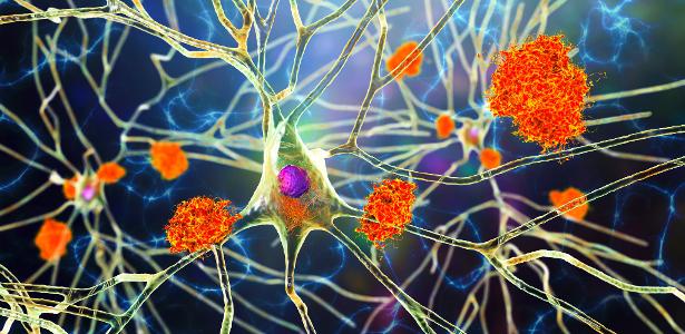 Molecule discovered by Brazilians is the new promise against Alzheimer's disease