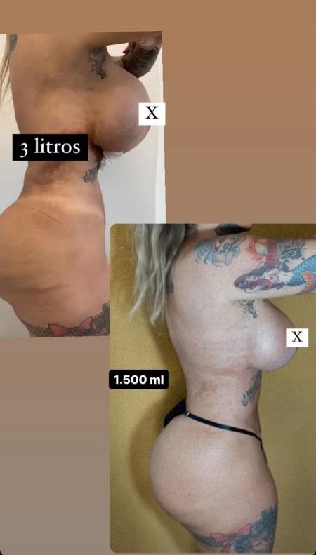 Sabrina Boing Boing mostra antes e depois dos seios