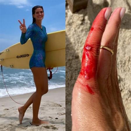 Isabella Fiorentino se machuca após dia de surf - Reprodução / Instagram
