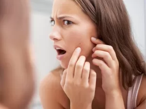 Como eliminar cravos no nariz e rosto? Dicas servem para espinhas também