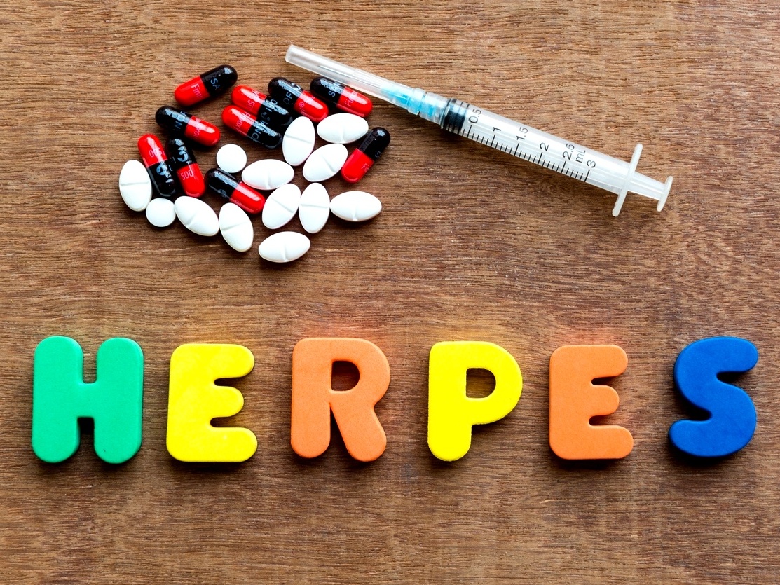 Herpes genital quais os sintomas, como evitar e tratar essa IST incurável - 17/11/2019