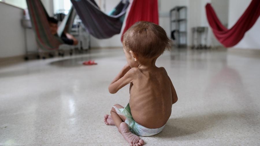 Criança Yanomami no Hospital Infantil Santo Antônio, em Boa Vista, em janeiro de 2023 - Michael Dantas/AFP