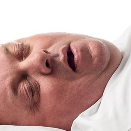 A apneia do sono pode causar ronco alto e respiração ruidosa enquanto a pessoa dorme - SCIENCE PHOTO LIBRARY
