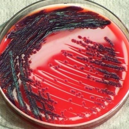 Pesquisadores da USP desvendaram a estratégia usada pela "Chromobacterium violaceum" para aumentar sua capacidade de replicação e infecção - Pete Seidel/CDC