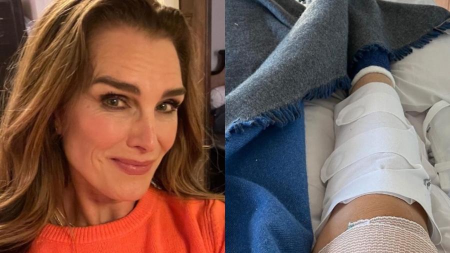 Brooke Shields fala sobre sua recuperação após quebrar o fêmur  - Reprodução/Instagram