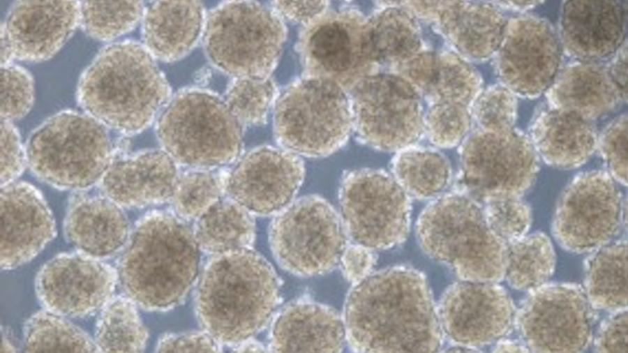 O zimislecel, novo medicamento testado para diabetes tipo 1, visto em microscópio O zimislecel, novo medicamento testado para diabetes tipo 1, visto em microscópio