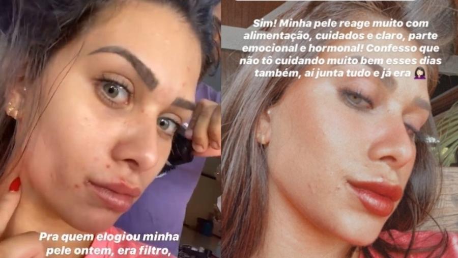 Flavia Pavanelli mostra sua pele com espinhas - Reprodução/Instagram
