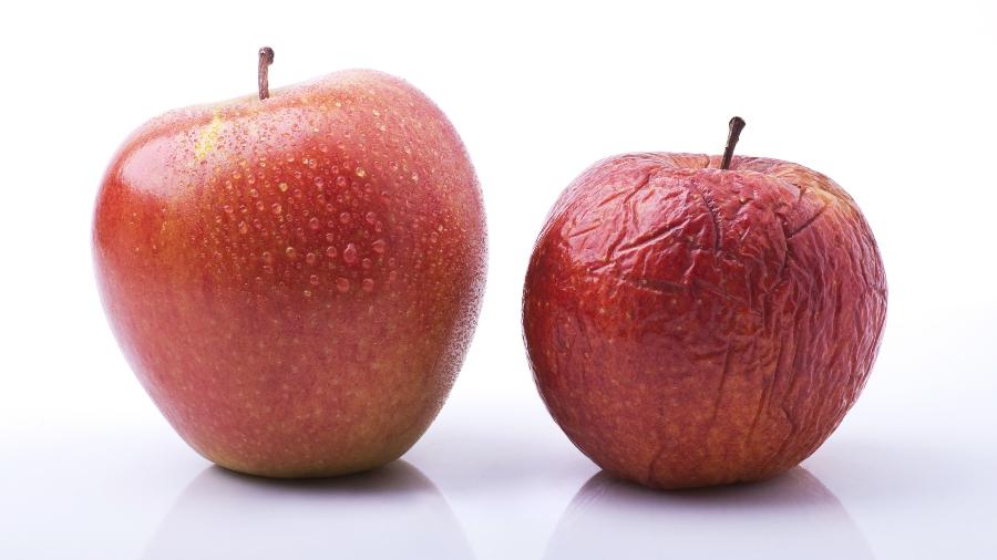 Flacidez pode ter motivos variados - iStock