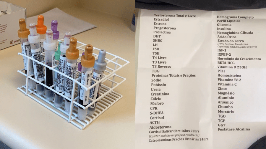 Juju Salimeni compartilhou a dezena de tubos e uma lista dos exames de rotina - Reprodução/Instagram/@jujusalimeni
