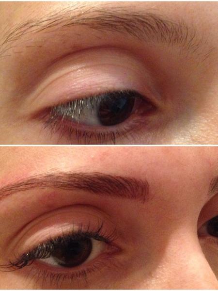 A micropigmentação fio a fio preenche falhas e define o desenho natural  - Divulgação/Haute Dermatologia e Estética  - Divulgação/Haute Dermatologia e Estética 