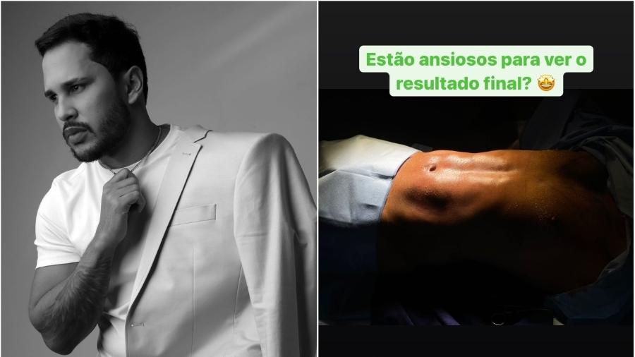 Lucas Guimarães mostra resultado de lipoaspiração no abdômen - Reprodução/Instagram @lucasguimaraes