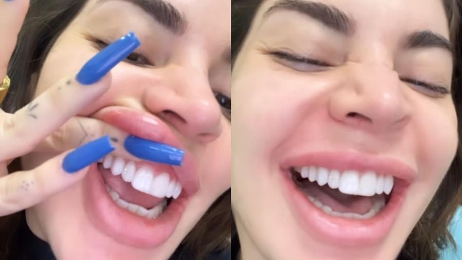 Gkay mostra passo a passo de joia colocada em seu dente - Reprodução/Instagram