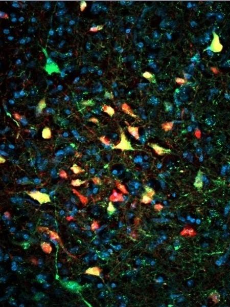Células VGAT da substância cinzenta periaquedutal em verde e em amarelo. As células vermelhas fazem contatos sinápticos em neurônios VGAT  - Acervo dos pesquisadores