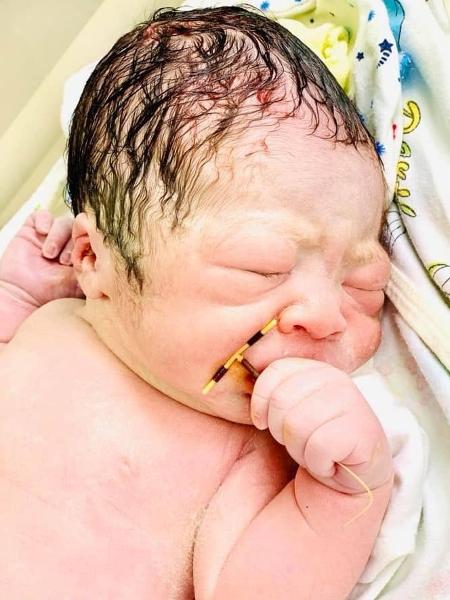 Bebê recém-nascido segurando DIU colocado pela mãe 2 anos antes do parto em hospital do Vietnã - Reprodução/Facebook