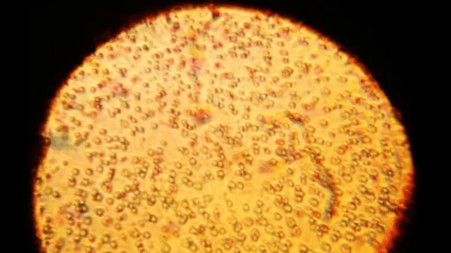 Imagem microscópica de uma amostra de leite materno humano - Getty Images via BBC News Brasil