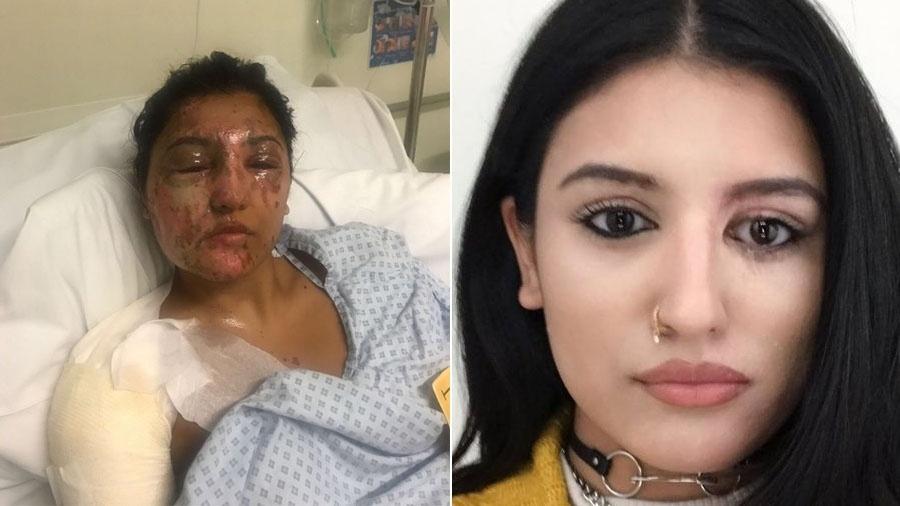 O antes e o depois de Resham Khan, que teve o rosto desfigurado em um ataque com ácido, em Londres - Fotos Reprodução/Daily Mirror e Twitter