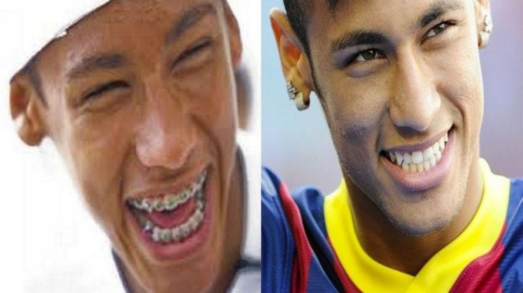 Neymar - Montagem - Montagem