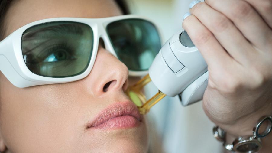 Tratamento com laser pode ser aplicado no rosto e em outras regiões - iStock
