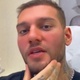 Lucas Lucco explica que nao gostou do resultao de harmonização facial - Reprodução/Instagram