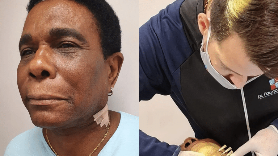 Carnaval 2023: Neguinho da Beija-Flor faz tratamento contra flacidez no pescoço - Divulgação