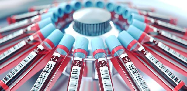 Innovative Blood Sample Testing for Diabetes, HIV, and COVID-19 Diagnosis