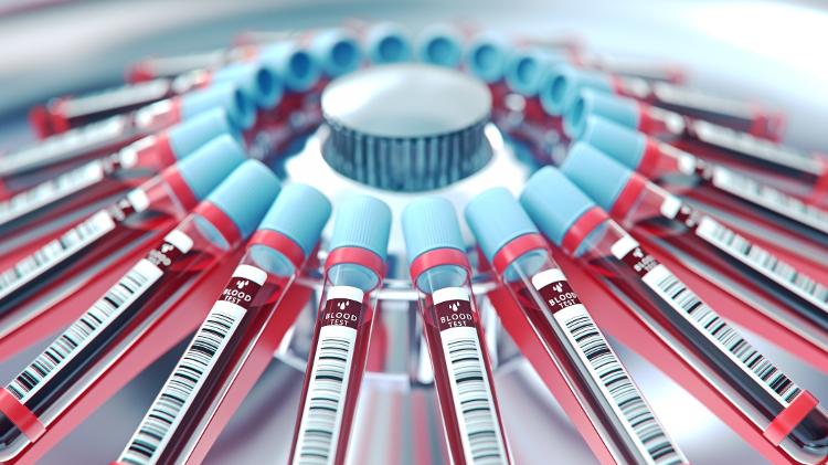 Febre amarela pode ser confirmada pela sorologia de amostras de sangue do paciente Febre amarela pode ser confirmada pela sorologia de amostras de sangue do paciente
