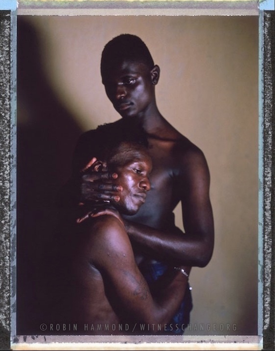 Rihana e Kim (na foto acima), de Uganda, na África - Robin Hammond