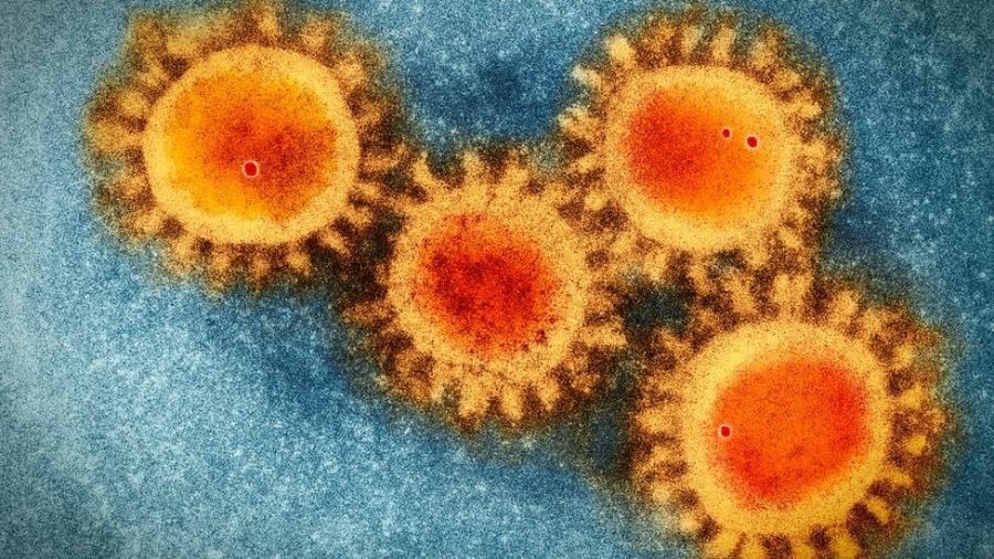 Imagem colorida de microscopia eletrônica do coronavírus - Getty Images