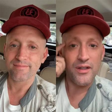 Paulo Gustavo aparece sem filtro ao assumir que aplica botox no rosto - Reprodução / Instagram