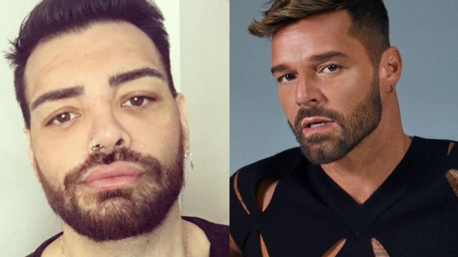 Fran Mariano após cirurgias plásticas para se parecer com Ricky Martin - Reprodução/Instagram