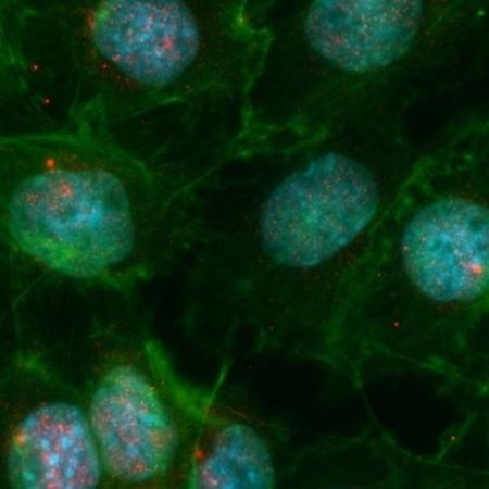 Imagem de imunofluorescência de células mTEC, onde o núcleo celular está em azul e os pontos vermelhos são a proteína Aire - Karina F. Bombonato-Prado (FORP-USP)