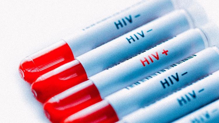 HIV, exame, teste - Getty Images - Getty Images