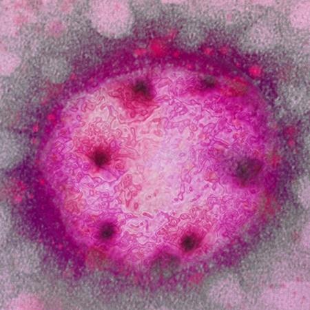 Micrografia eletrônica do arenavírus - Arte sobre foto de E.L. Palmer/USCDCP/Pixnio CC