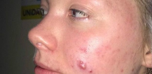 Katy mostra como sua pele fica quando não usa maquiagem - Arquivo Pessoal - Arquivo Pessoal