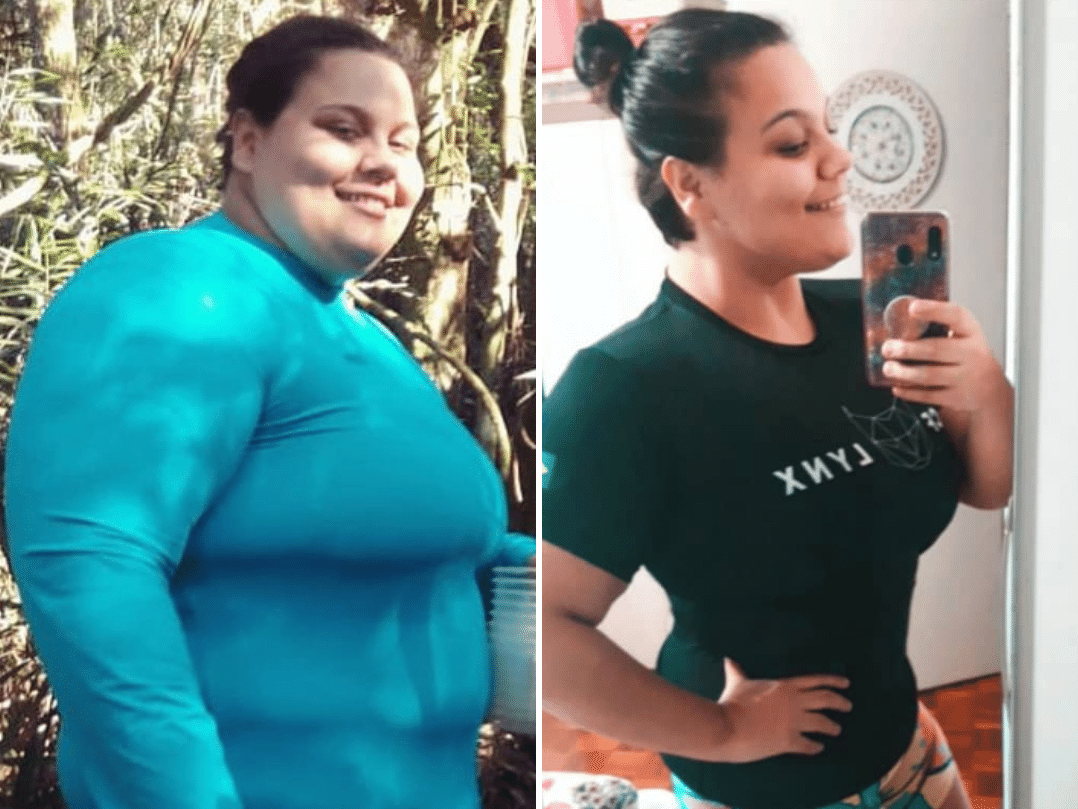 Obesa aos 22, Isabelle colocou balão intragástrico, mudou hábitos e perdeu 46 kg