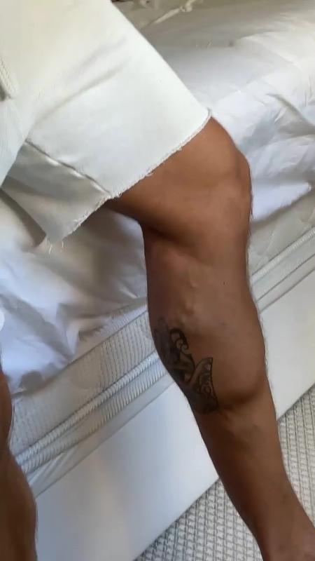 Jonas Sulzbach mostrou imagens da perna - Reprodução/Instagram @jonas.mbt - Reprodução/Instagram @jonas.mbt