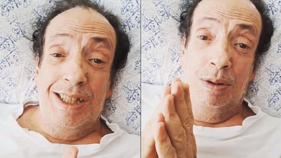 Marcos Oliveira, o Beiçola, recebe alta após cirurgia e pede ajuda - Reprodução/Instagram