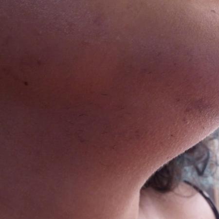 pelos no corpo - Arquivo pessoal - Arquivo pessoal